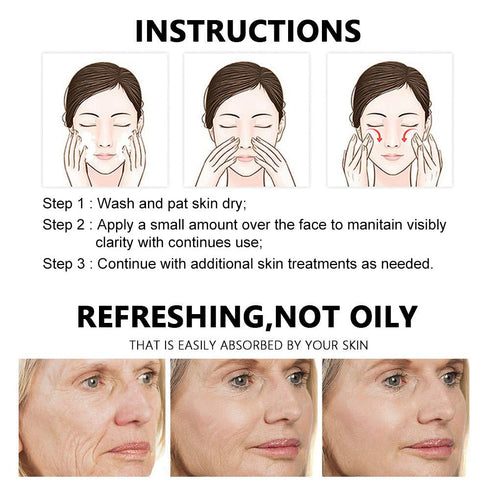 SalicylicI Acid 2% Serum Mild Peel Acne Scrs Clarifying Pores Sebum
